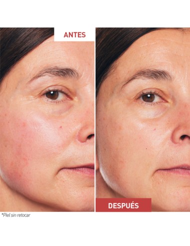 ERBORIAN SKIN THERAPY BIFASICO 30ML